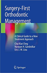Surgery-First Orthodontic Management: A Clinical Guide to a New Treatment Approa